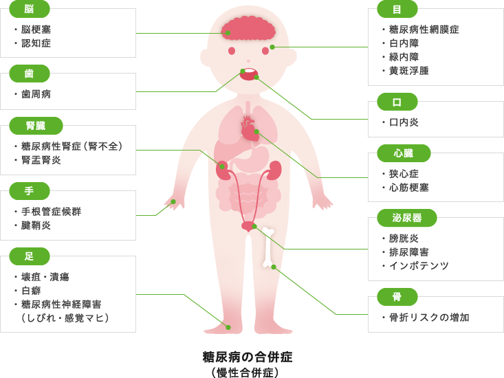 糖尿病の合併症(慢性合併症)