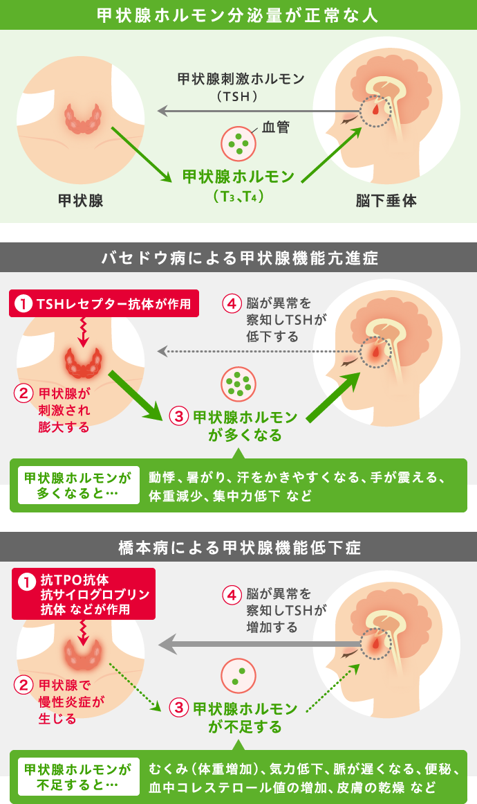 低下 甲状腺 チェック 機能 症 症状